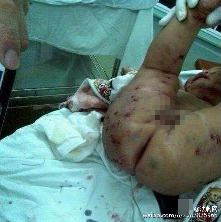 男婴吃奶时咬痛妈妈﹐妈妈用剪刀捅90下(4)